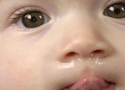 آبریزش بینی نوزاد؛ آیا به دلیل رشد دندان جدید است؟