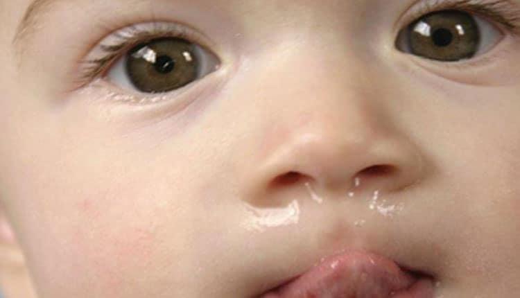 آبریزش بینی نوزاد؛ آیا به دلیل رشد دندان جدید است؟